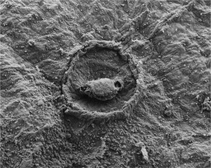 Scanning electron microscopy displaying the epithelial topography of the push-rod receptors found along anterior and posterior sections of the remora disc lip. Credit: NJIT, FHL-UW, GWU.