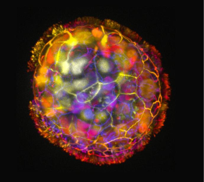 Depth colored image showing the multicellular structure o f an Anthrobot, surrounded by cilia on its surface, which enables it to move and explore its environment. Credit: Gizem Gumuskaya, Tufts University