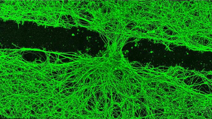 Neurons (green) re - grew across a gap after Anthrobots were introduced, showing repair where the bots settled. Credit:Gizem Gumuskaya, Tufts University