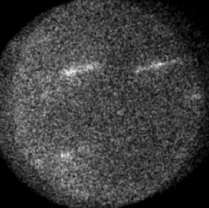 A gamma-ray counts map over a three-month period of Jupiter, generated by Lomuscio using Fermi’s all-sky image data and a modified tracking method. Bright streaks are a result of gamma-ray sources, such as a quasar or blazar, in the background of Jupiter.